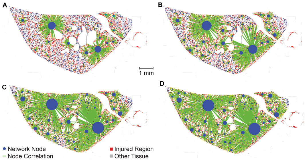 A scale-free model of acute and ventilator-induced lung injury: a network theory approach inspired by seismology
